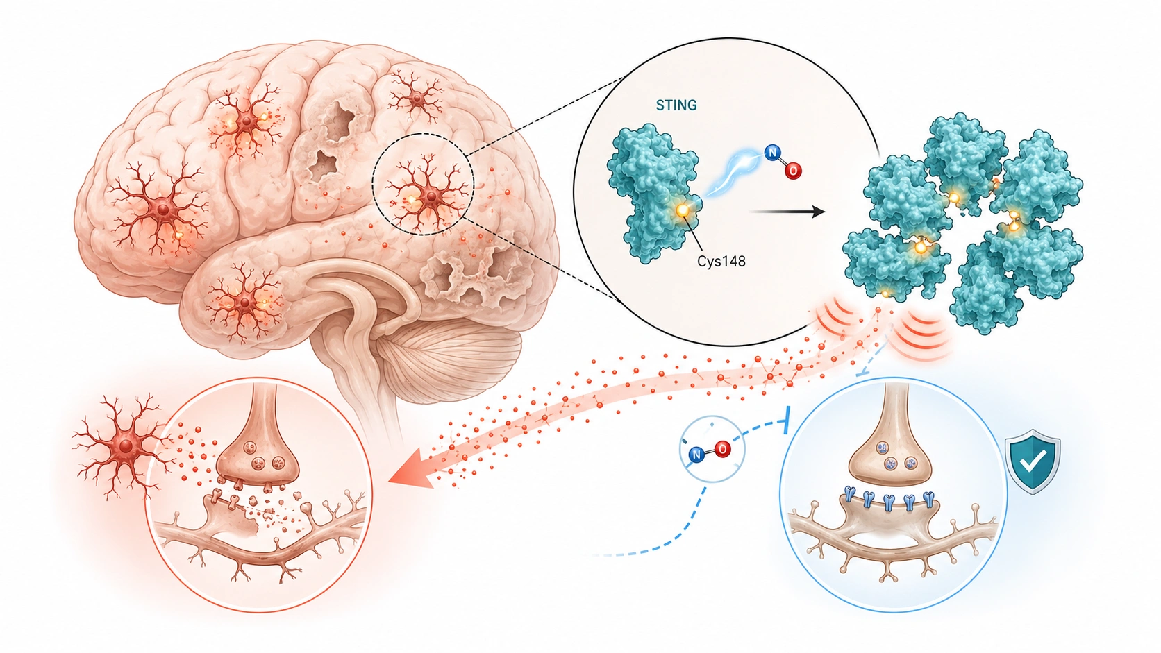 A Hidden Immune Switch May Be Fueling Alzheimers