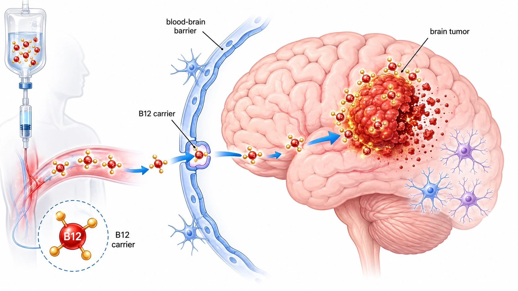 Vitamin B12-Based Compound Shows Promise Against Brain Cancer