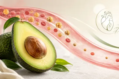 One Avocado a Day May Lower Cholesterol, Study Finds